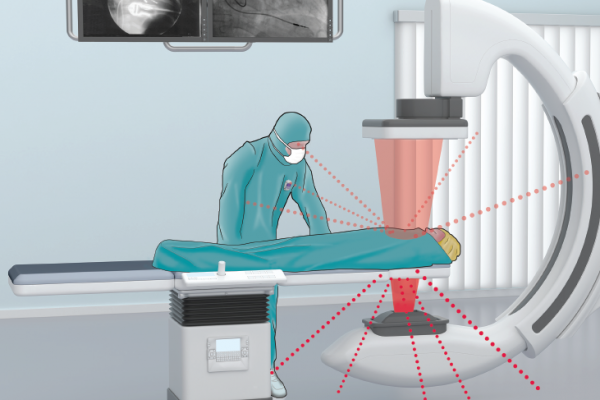 Visualizing scatter radiation